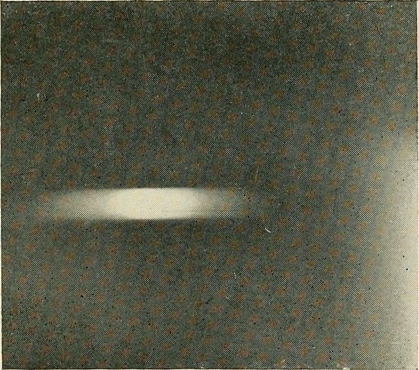 An illustration from Localization by X-rays and stereoscopy, 1916, leaf 28