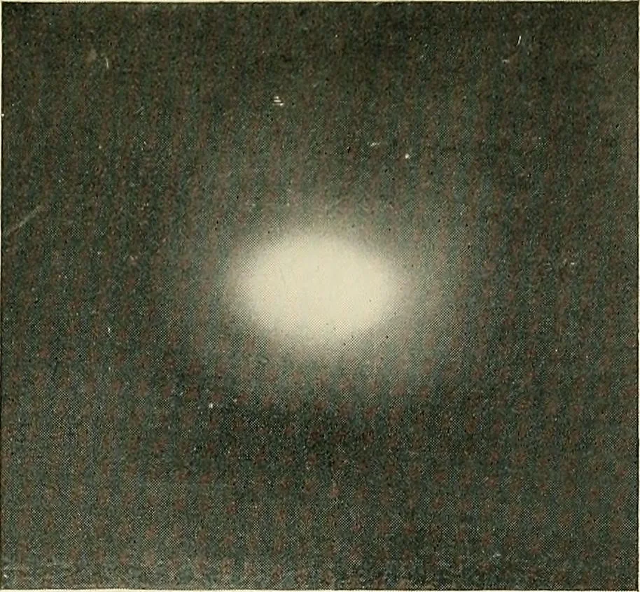 An illustration from Localization by X-rays and stereoscopy, 1916, leaf 28