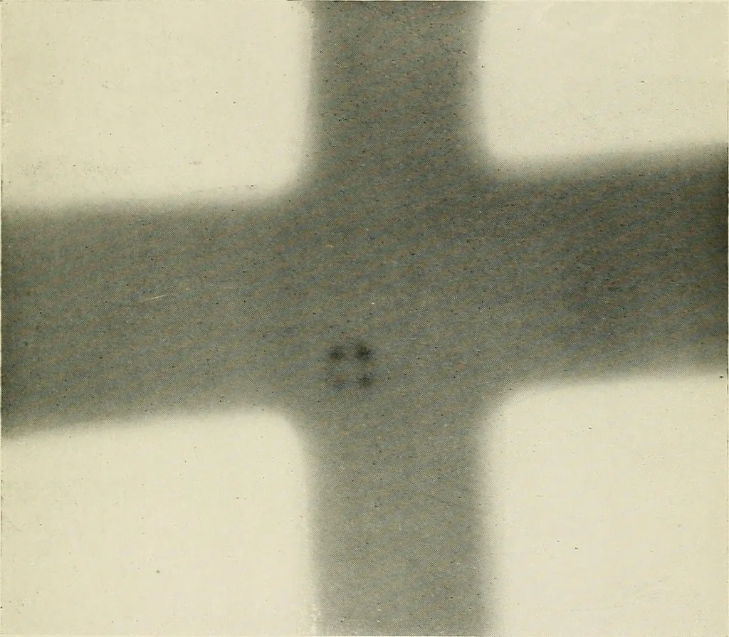 An illustration from Localization by X-rays and stereoscopy, 1916, leaf 40