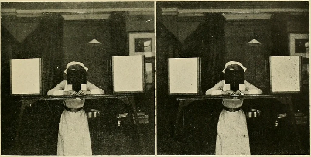 An illustration from Localization by X-rays and stereoscopy, 1916, leaf 54