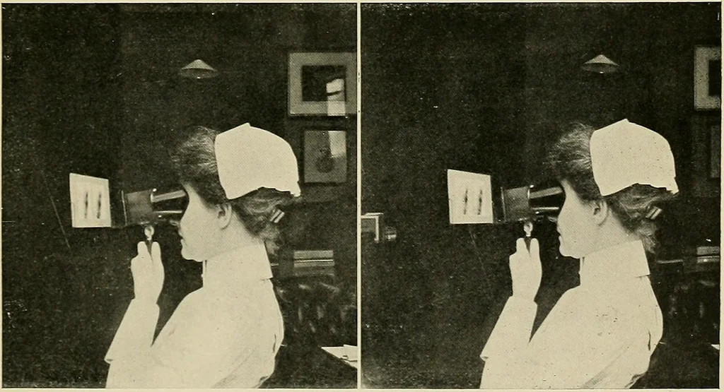 An illustration from Localization by X-rays and stereoscopy, 1916, leaf 54