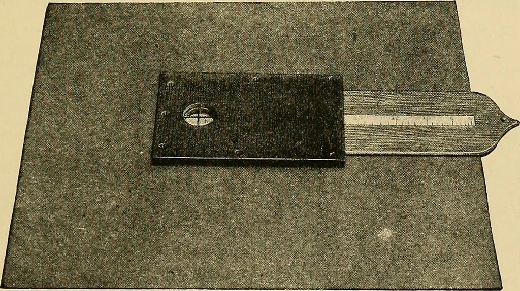 An illustration from Localization by X-rays and stereoscopy, 1916, leaf 64