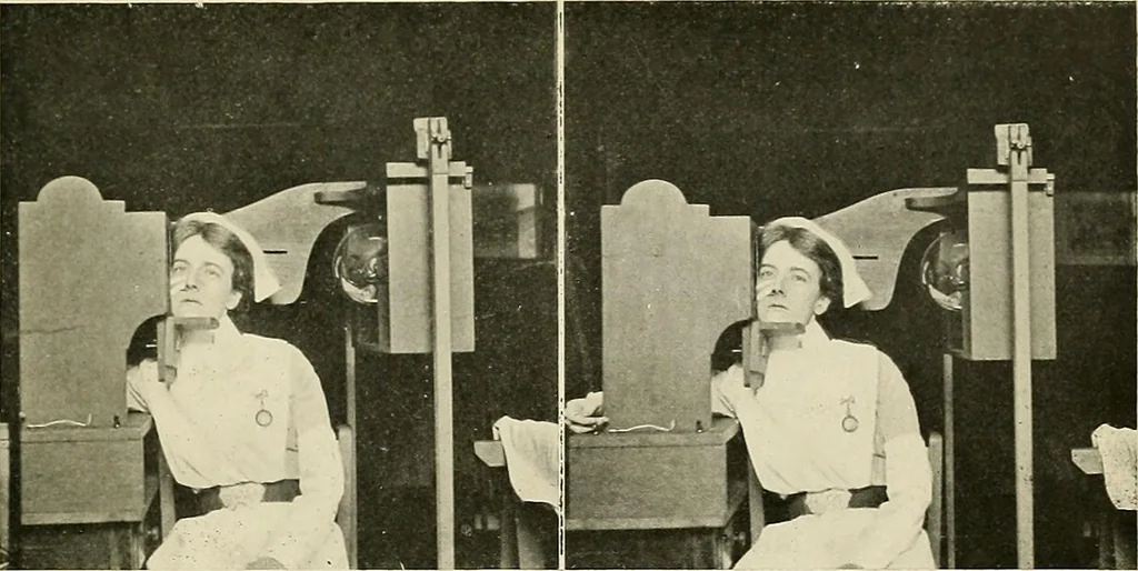 An illustration from Localization by X-rays and stereoscopy, 1916, leaf 88