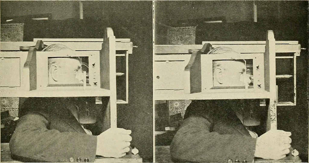 An illustration from Localization by X-rays and stereoscopy, 1916, leaf 88