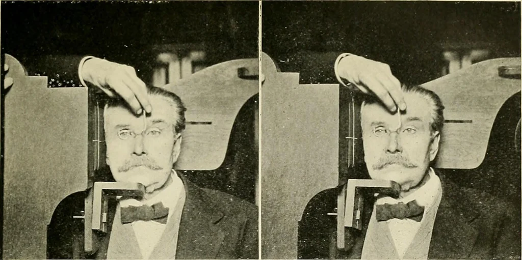An illustration from Localization by X-rays and stereoscopy, 1916, leaf 92