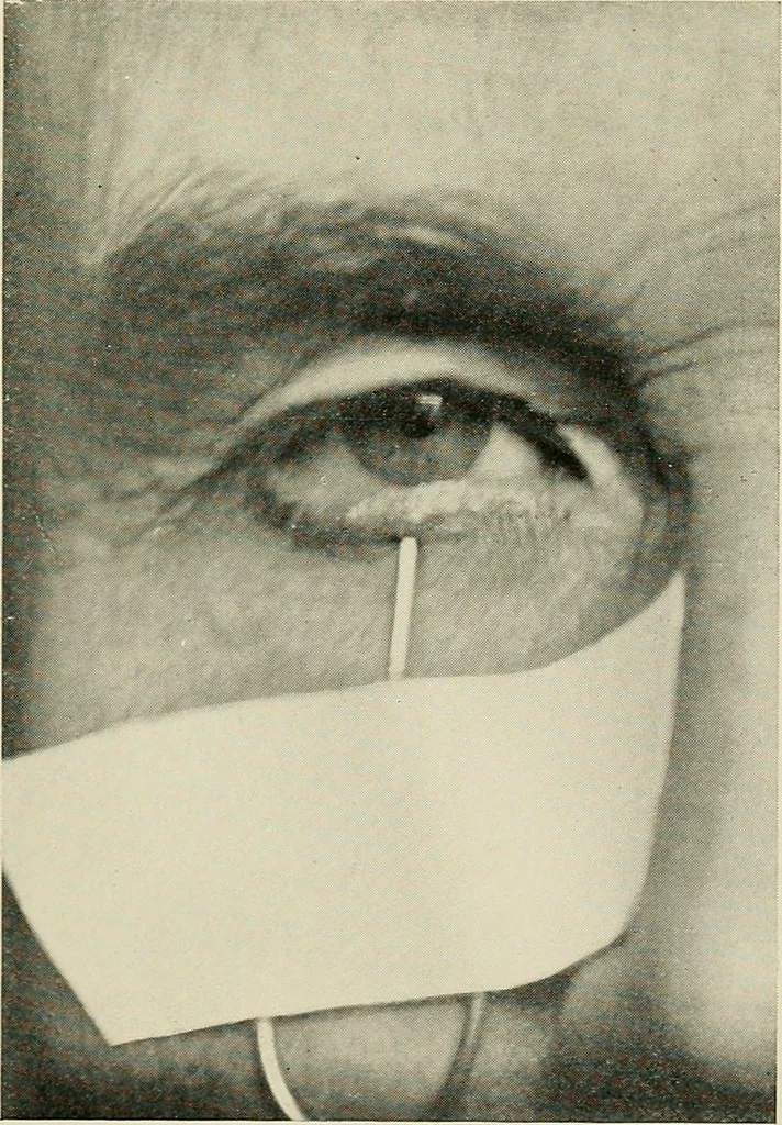 An illustration from Localization by X-rays and stereoscopy, 1916, leaf 92