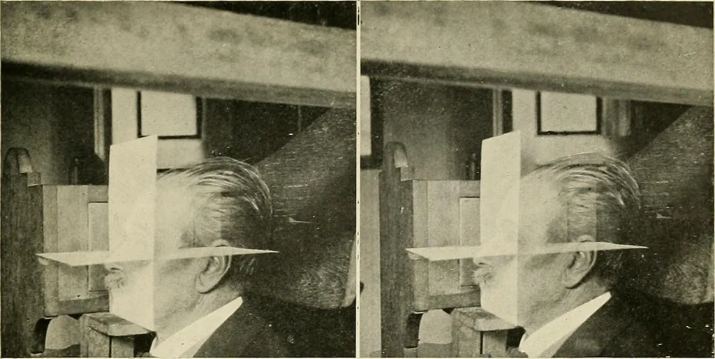 An illustration from Localization by X-rays and stereoscopy, 1916, leaf 98
