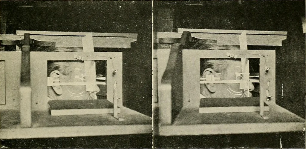 An illustration from Localization by X-rays and stereoscopy, 1916, leaf 98