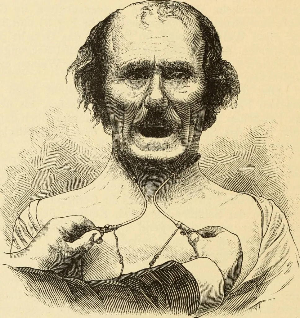 An illustration from Magnetismus und Hypnotismus; eine Darstellung dieses Gebietes, mit besonderer Berücksichtigung der Beziehungen zwischen dem mineralischen Magnetismus, dem sogenannten thierischen Magnetismus und dem Hypnotismus, 1895, leaf 153