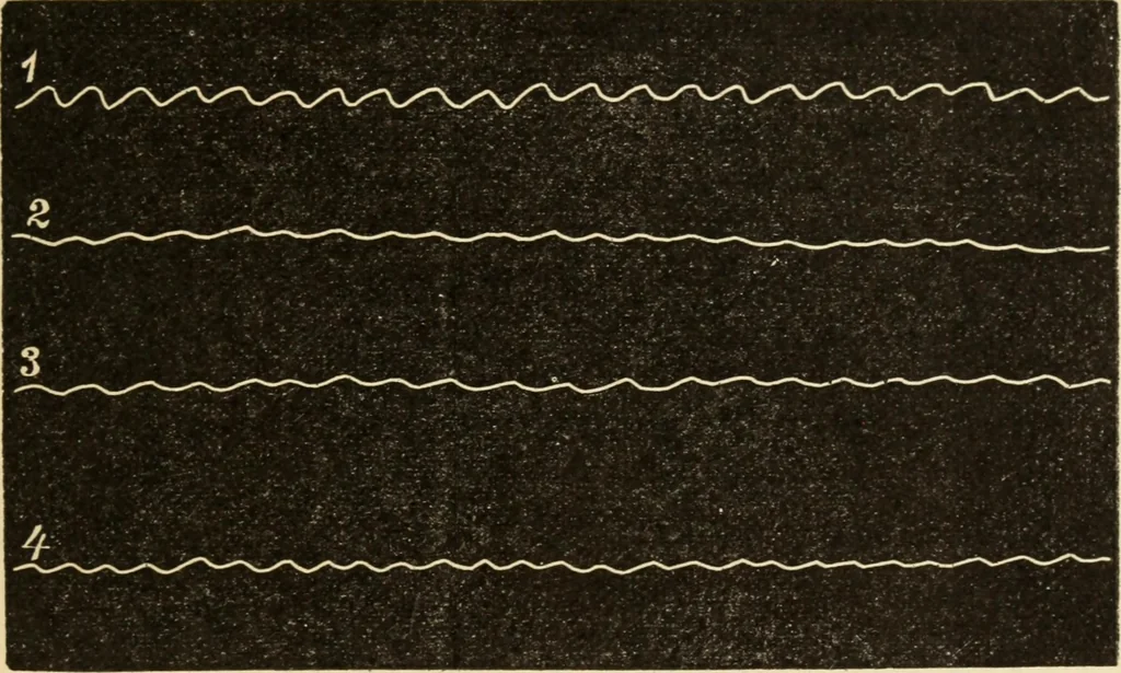 An illustration from Magnetismus und Hypnotismus; eine Darstellung dieses Gebietes, mit besonderer Berücksichtigung der Beziehungen zwischen dem mineralischen Magnetismus, dem sogenannten thierischen Magnetismus und dem Hypnotismus, 1895, leaf 166
