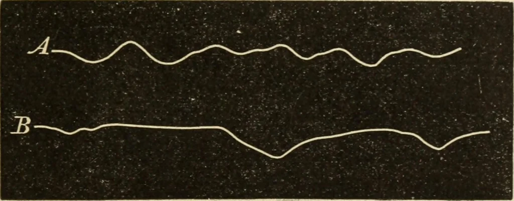 An illustration from Magnetismus und Hypnotismus; eine Darstellung dieses Gebietes, mit besonderer Berücksichtigung der Beziehungen zwischen dem mineralischen Magnetismus, dem sogenannten thierischen Magnetismus und dem Hypnotismus, 1895, leaf 192