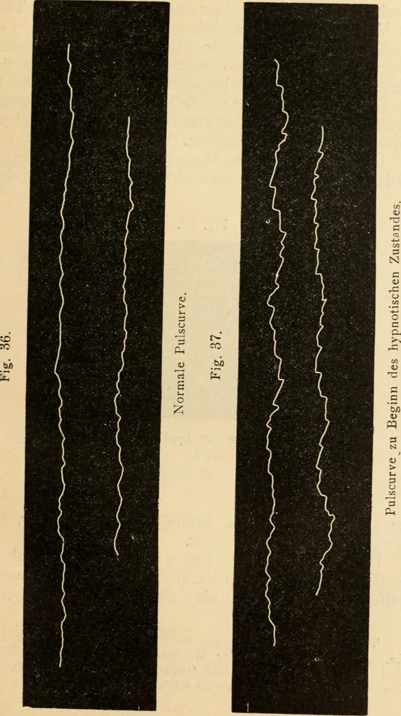 An illustration from Magnetismus und Hypnotismus; eine Darstellung dieses Gebietes, mit besonderer Berücksichtigung der Beziehungen zwischen dem mineralischen Magnetismus, dem sogenannten thierischen Magnetismus und dem Hypnotismus, 1895, leaf 194