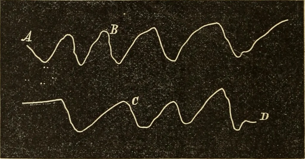 An illustration from Magnetismus und Hypnotismus; eine Darstellung dieses Gebietes, mit besonderer Berücksichtigung der Beziehungen zwischen dem mineralischen Magnetismus, dem sogenannten thierischen Magnetismus und dem Hypnotismus, 1895, leaf 195