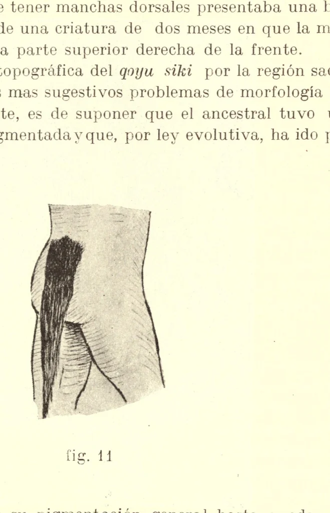 An illustration from Qoyu siki; manchas cutáneas congénitas de los aborígenes del Perú, 1915, leaf 25