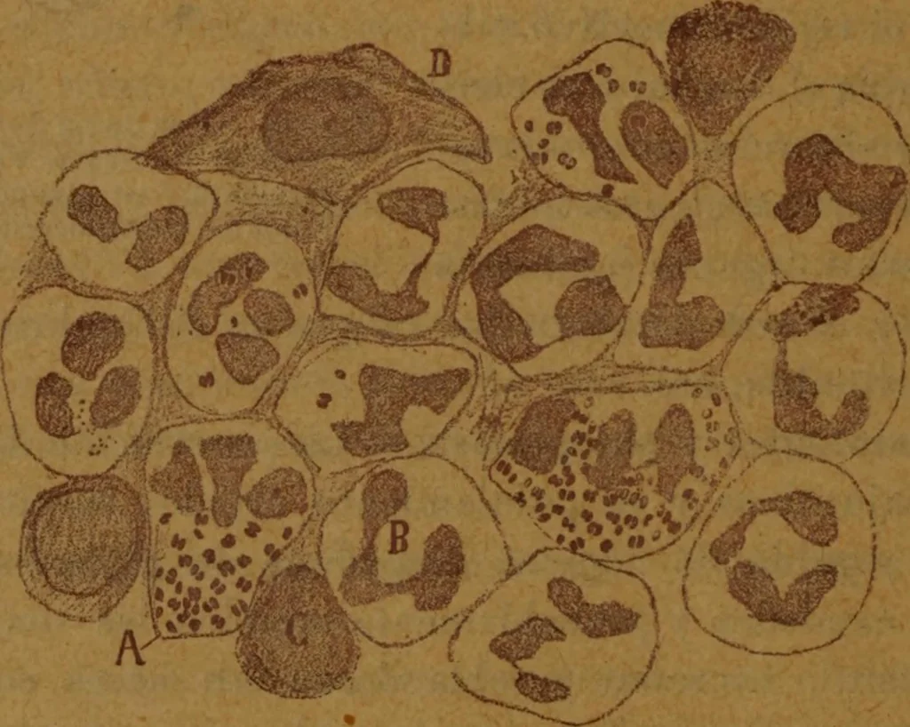 An illustration from Manual de anatomía patológica general : seguida de un resumen de microscopia aplicada a la histología y bacteriología patológicas, 1896, leaf 151