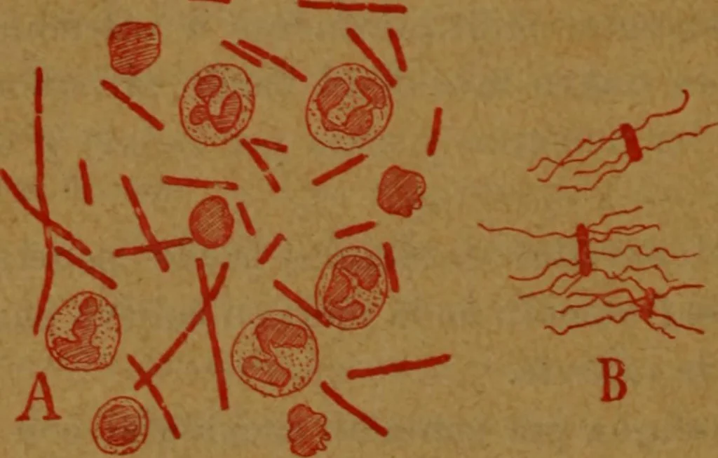 An illustration from Manual de anatomía patológica general : seguida de un resumen de microscopia aplicada a la histología y bacteriología patológicas, 1896, leaf 165