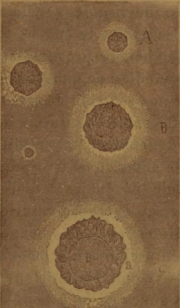 An illustration from Manual de anatomía patológica general : seguida de un resumen de microscopia aplicada a la histología y bacteriología patológicas, 1896, leaf 180