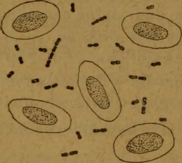 An illustration from Manual de anatomía patológica general : seguida de un resumen de microscopia aplicada a la histología y bacteriología patológicas, 1896, leaf 187