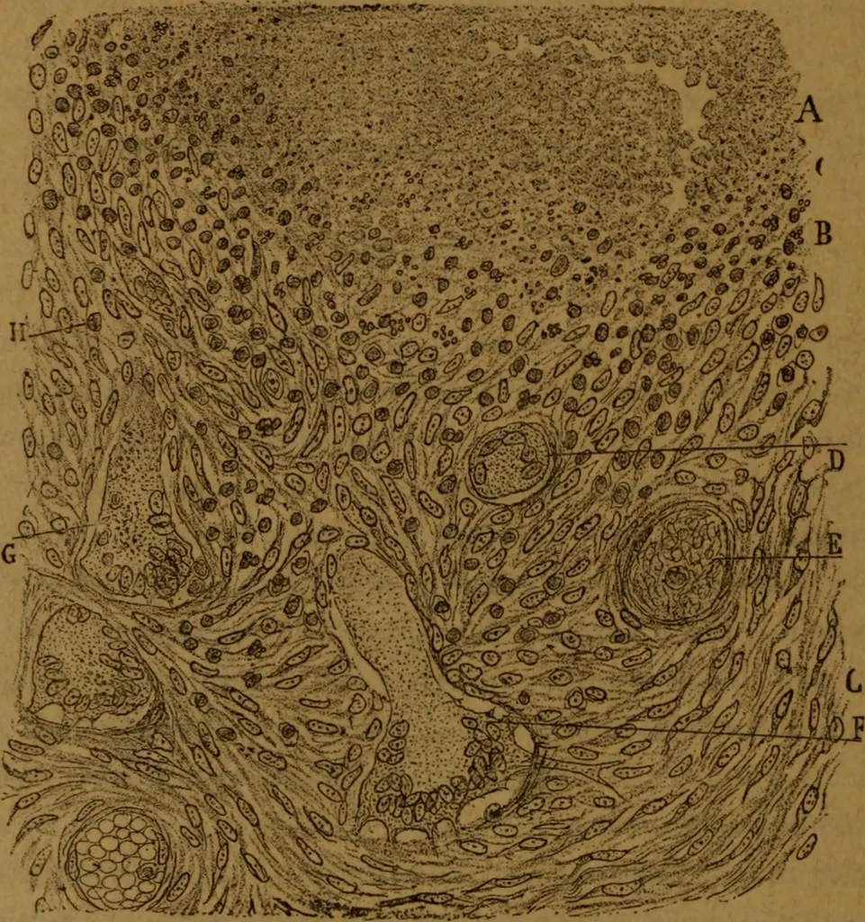 An illustration from Manual de anatomía patológica general : seguida de un resumen de microscopia aplicada a la histología y bacteriología patológicas, 1896, leaf 199
