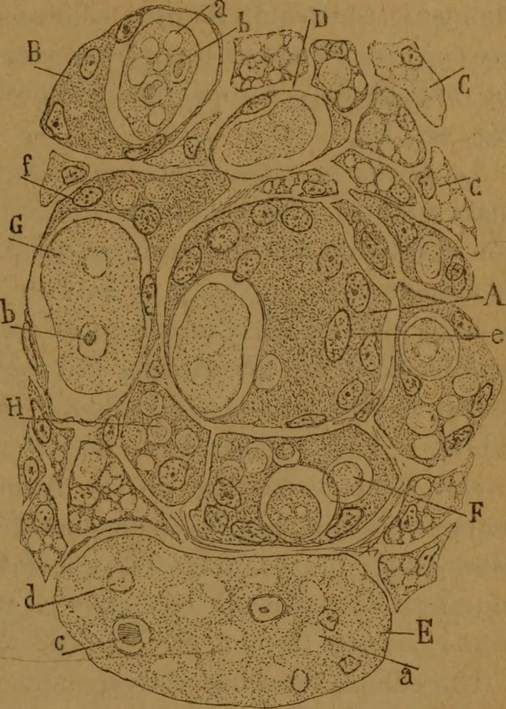 An illustration from Manual de anatomía patológica general : seguida de un resumen de microscopia aplicada a la histología y bacteriología patológicas, 1896, leaf 210
