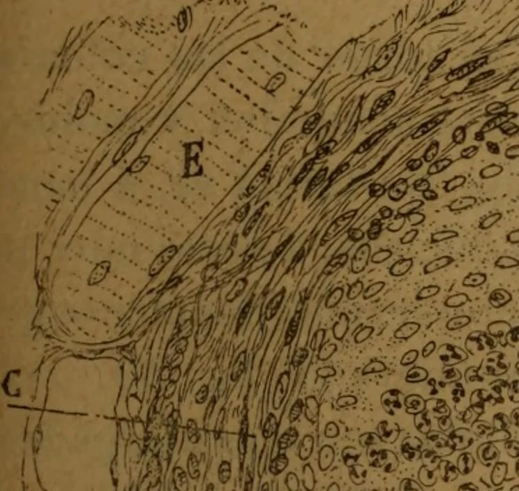 An illustration from Manual de anatomía patológica general : seguida de un resumen de microscopia aplicada a la histología y bacteriología patológicas, 1896, leaf 218