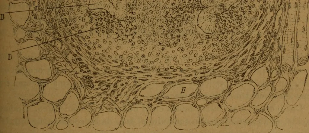 An illustration from Manual de anatomía patológica general : seguida de un resumen de microscopia aplicada a la histología y bacteriología patológicas, 1896, leaf 218