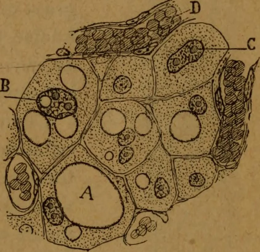 An illustration from Manual de anatomía patológica general : seguida de un resumen de microscopia aplicada a la histología y bacteriología patológicas, 1896, leaf 22