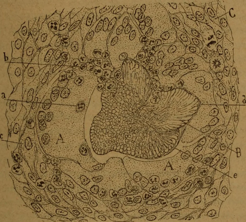 An illustration from Manual de anatomía patológica general : seguida de un resumen de microscopia aplicada a la histología y bacteriología patológicas, 1896, leaf 220