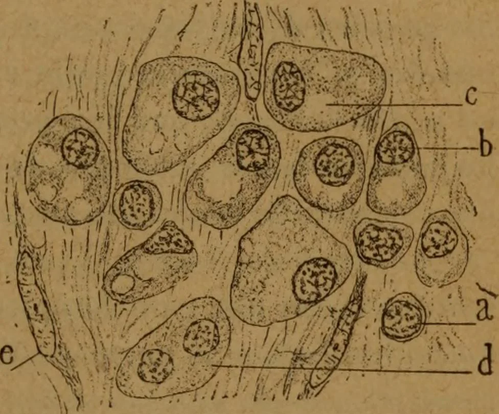An illustration from Manual de anatomía patológica general : seguida de un resumen de microscopia aplicada a la histología y bacteriología patológicas, 1896, leaf 226