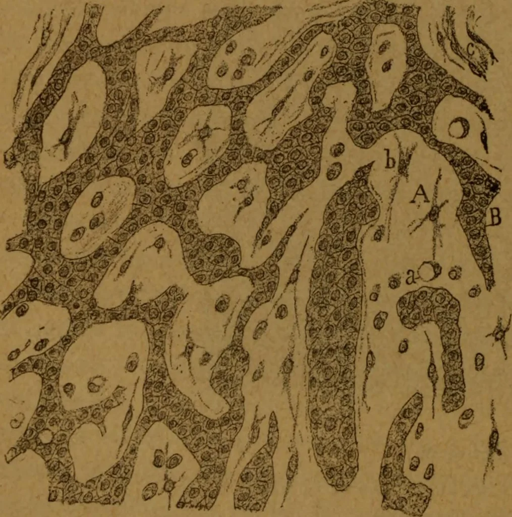 An illustration from Manual de anatomía patológica general : seguida de un resumen de microscopia aplicada a la histología y bacteriología patológicas, 1896, leaf 267