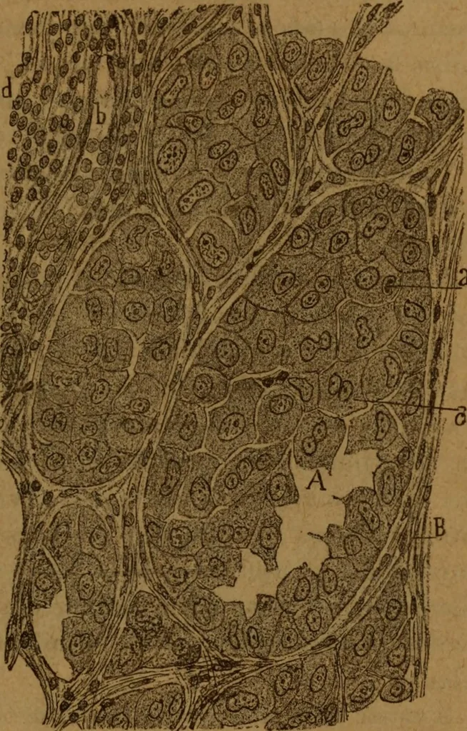 An illustration from Manual de anatomía patológica general : seguida de un resumen de microscopia aplicada a la histología y bacteriología patológicas, 1896, leaf 268