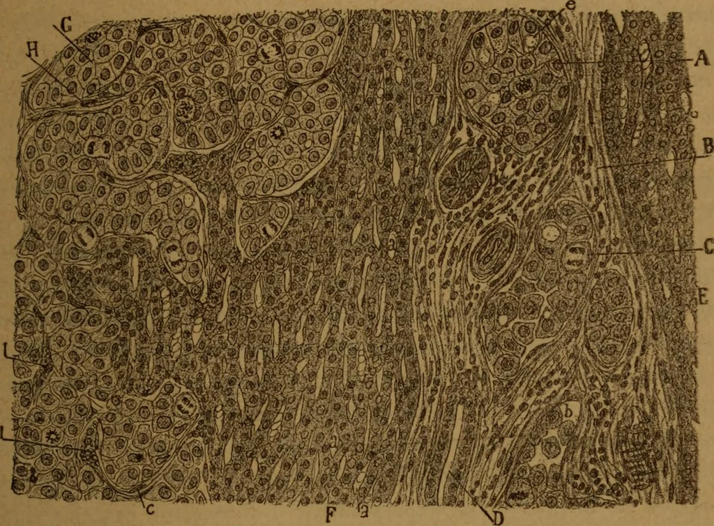 An illustration from Manual de anatomía patológica general : seguida de un resumen de microscopia aplicada a la histología y bacteriología patológicas, 1896, leaf 270