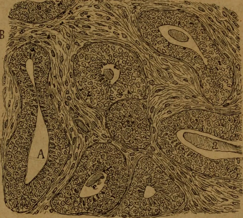 An illustration from Manual de anatomía patológica general : seguida de un resumen de microscopia aplicada a la histología y bacteriología patológicas, 1896, leaf 278