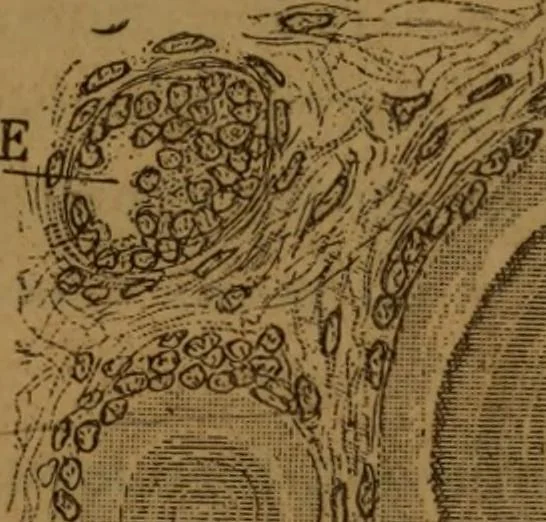 An illustration from Manual de anatomía patológica general : seguida de un resumen de microscopia aplicada a la histología y bacteriología patológicas, 1896, leaf 28