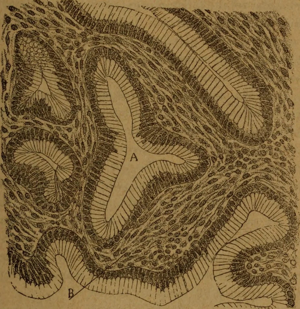 An illustration from Manual de anatomía patológica general : seguida de un resumen de microscopia aplicada a la histología y bacteriología patológicas, 1896, leaf 280
