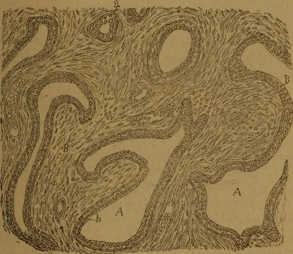 An illustration from Manual de anatomía patológica general : seguida de un resumen de microscopia aplicada a la histología y bacteriología patológicas, 1896, leaf 284