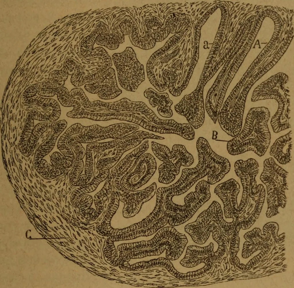 An illustration from Manual de anatomía patológica general : seguida de un resumen de microscopia aplicada a la histología y bacteriología patológicas, 1896, leaf 286