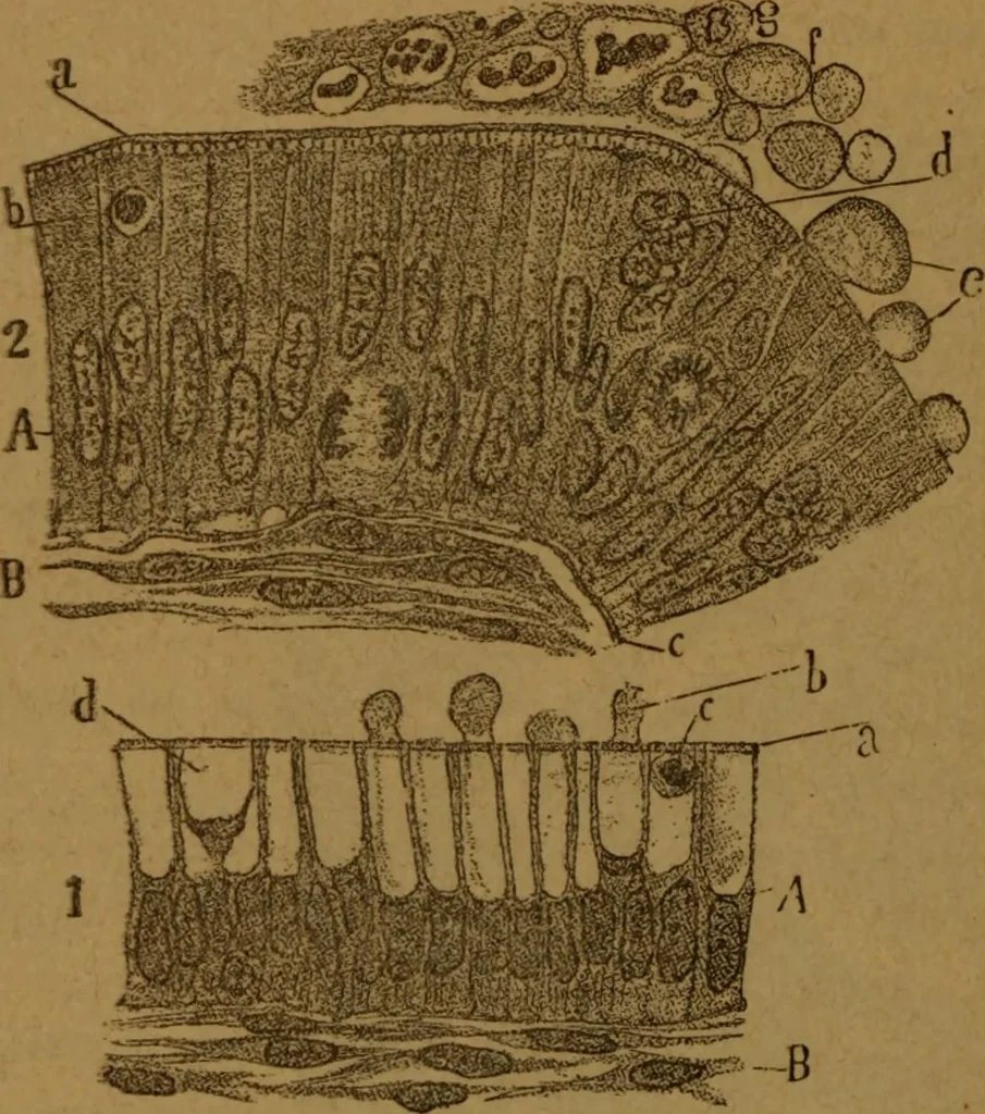 An illustration from Manual de anatomía patológica general : seguida de un resumen de microscopia aplicada a la histología y bacteriología patológicas, 1896, leaf 287