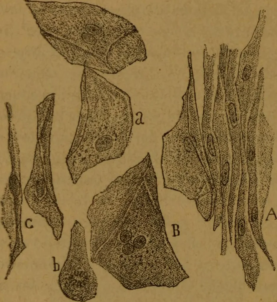 An illustration from Manual de anatomía patológica general : seguida de un resumen de microscopia aplicada a la histología y bacteriología patológicas, 1896, leaf 289