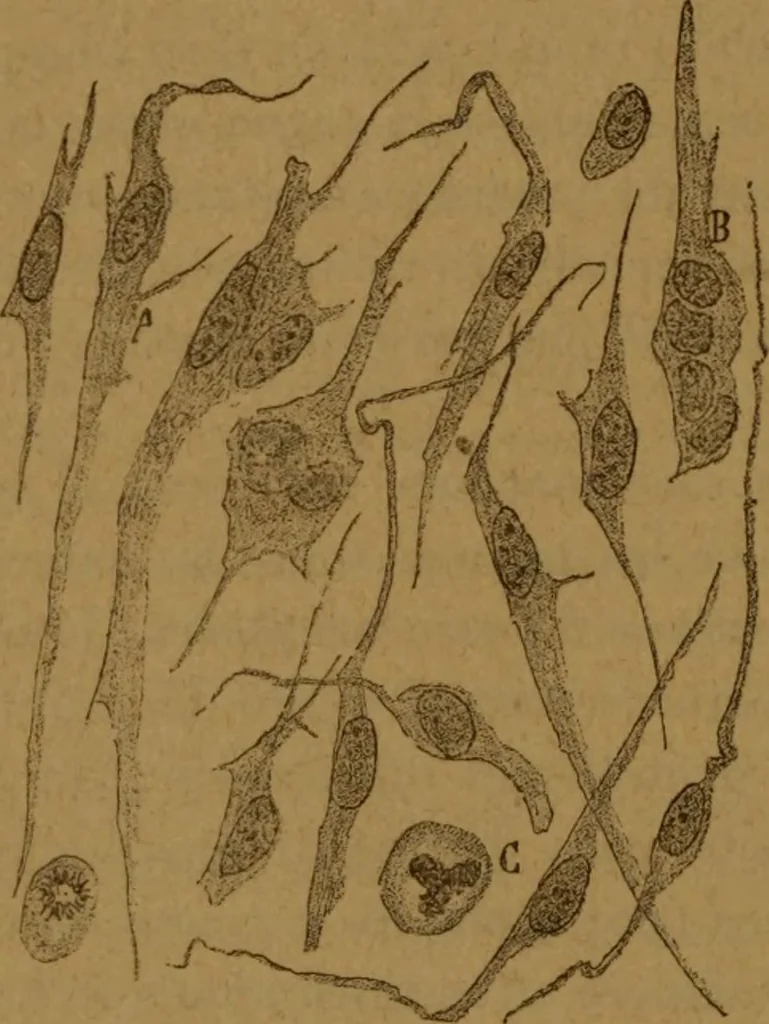 An illustration from Manual de anatomía patológica general : seguida de un resumen de microscopia aplicada a la histología y bacteriología patológicas, 1896, leaf 295