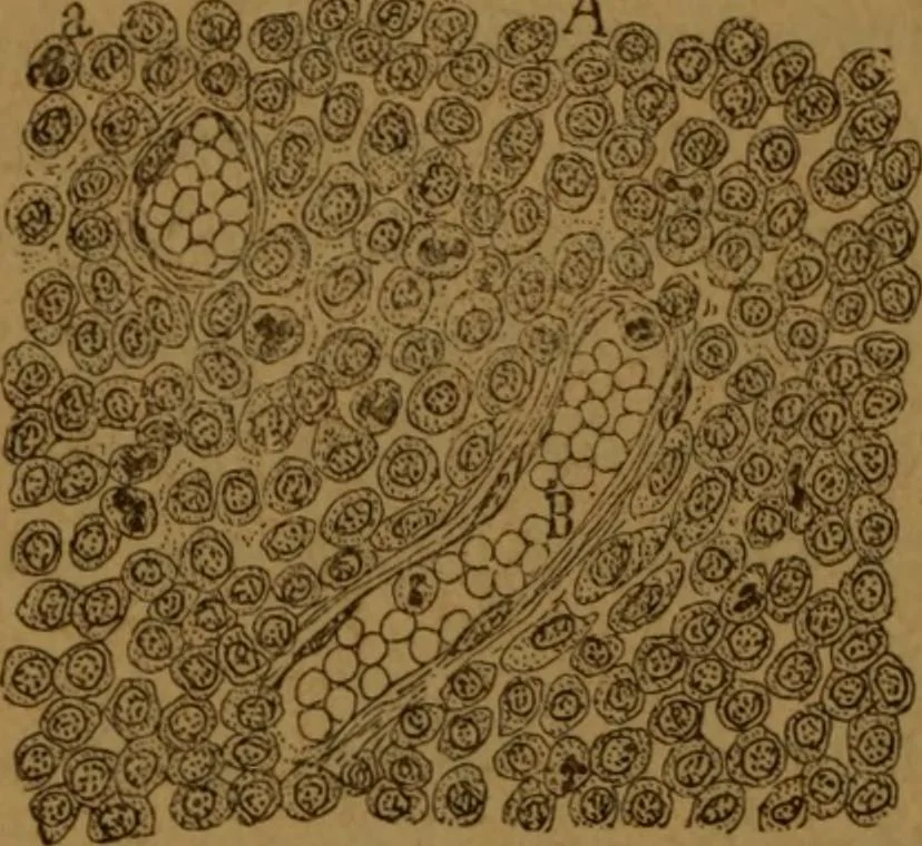 An illustration from Manual de anatomía patológica general : seguida de un resumen de microscopia aplicada a la histología y bacteriología patológicas, 1896, leaf 297