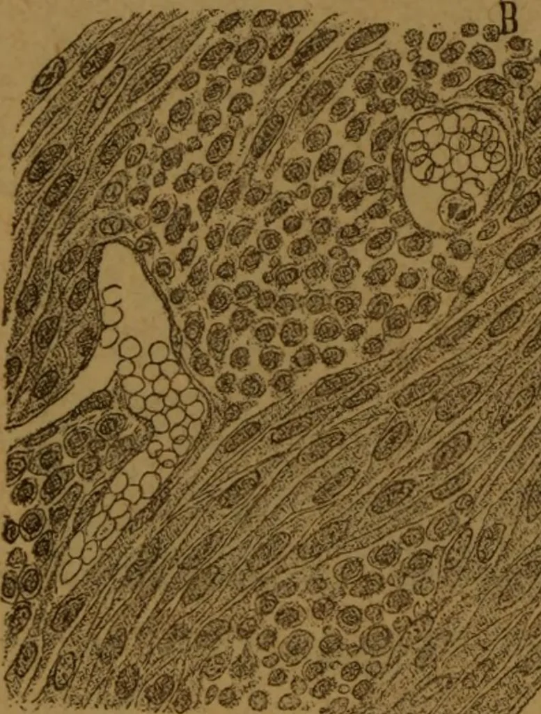 An illustration from Manual de anatomía patológica general : seguida de un resumen de microscopia aplicada a la histología y bacteriología patológicas, 1896, leaf 299