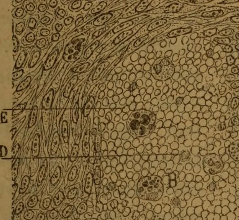 An illustration from Manual de anatomía patológica general : seguida de un resumen de microscopia aplicada a la histología y bacteriología patológicas, 1896, leaf 300