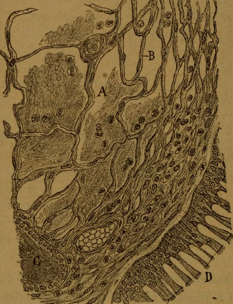 An illustration from Manual de anatomía patológica general : seguida de un resumen de microscopia aplicada a la histología y bacteriología patológicas, 1896, leaf 309