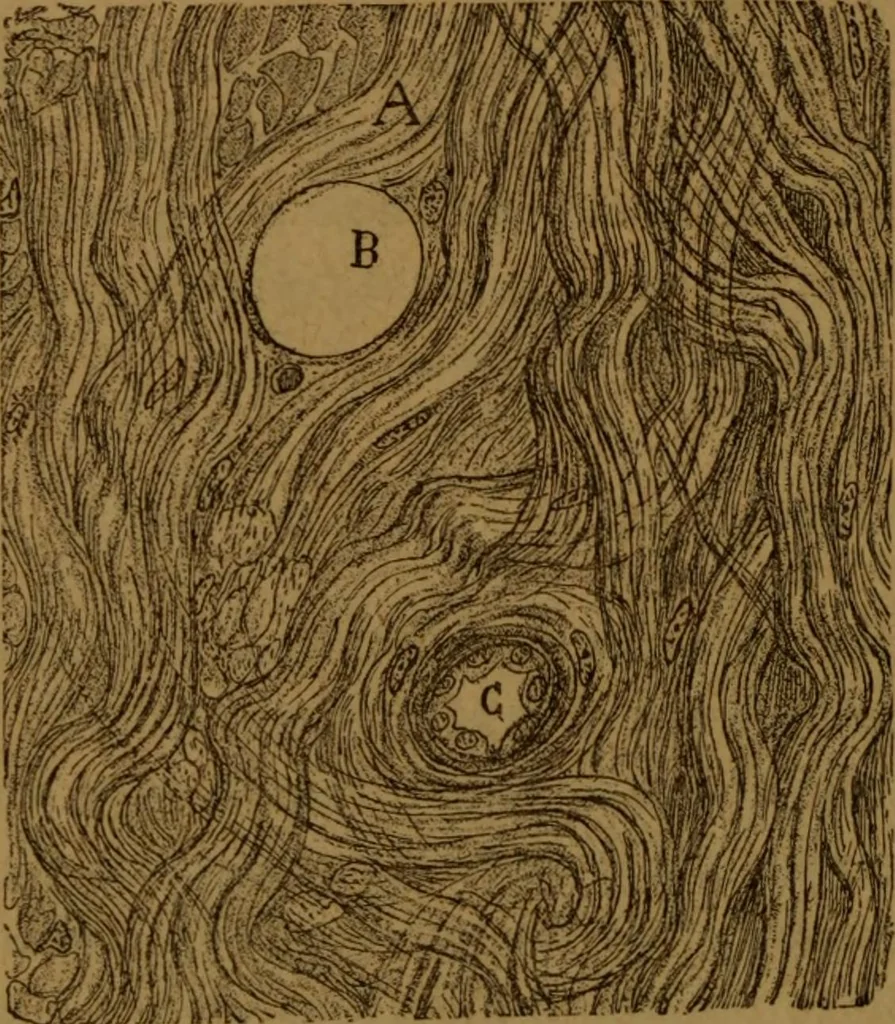 An illustration from Manual de anatomía patológica general : seguida de un resumen de microscopia aplicada a la histología y bacteriología patológicas, 1896, leaf 311