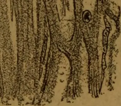 An illustration from Manual de anatomía patológica general : seguida de un resumen de microscopia aplicada a la histología y bacteriología patológicas, 1896, leaf 313