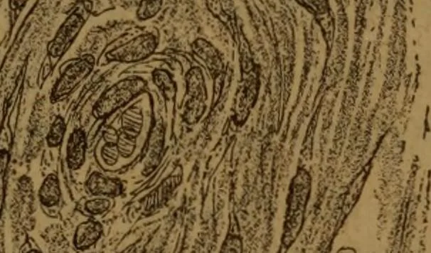 An illustration from Manual de anatomía patológica general : seguida de un resumen de microscopia aplicada a la histología y bacteriología patológicas, 1896, leaf 314