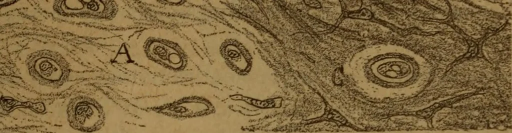 An illustration from Manual de anatomía patológica general : seguida de un resumen de microscopia aplicada a la histología y bacteriología patológicas, 1896, leaf 318