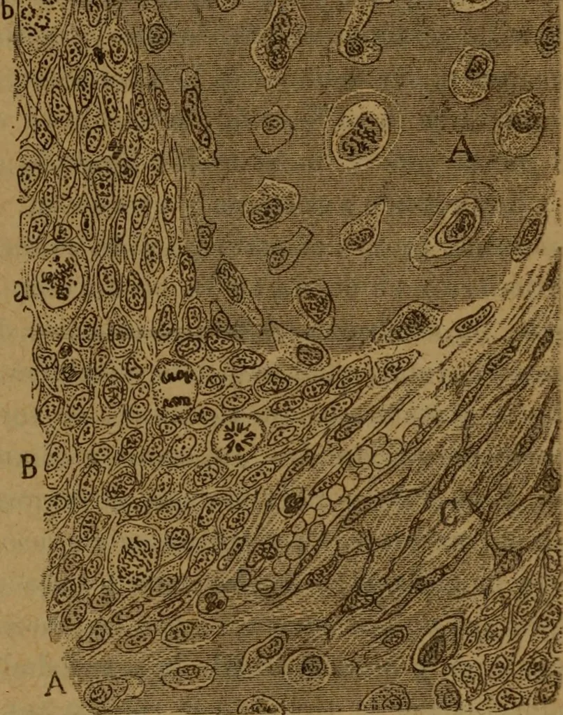 An illustration from Manual de anatomía patológica general : seguida de un resumen de microscopia aplicada a la histología y bacteriología patológicas, 1896, leaf 320