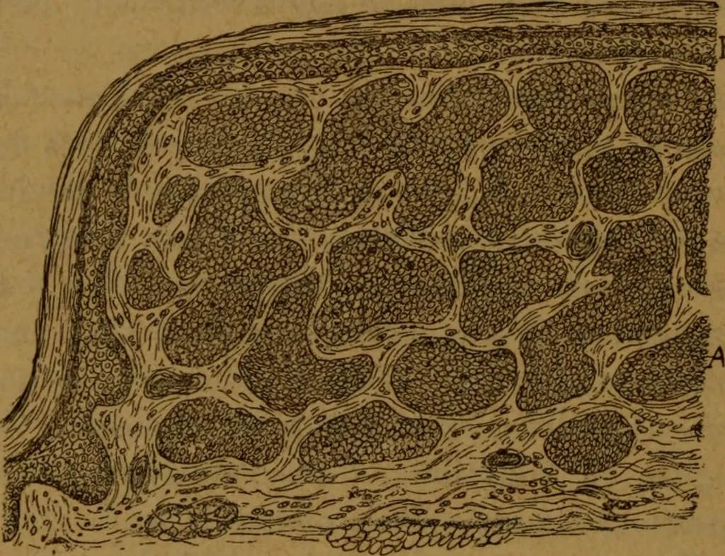 An illustration from Manual de anatomía patológica general : seguida de un resumen de microscopia aplicada a la histología y bacteriología patológicas, 1896, leaf 331